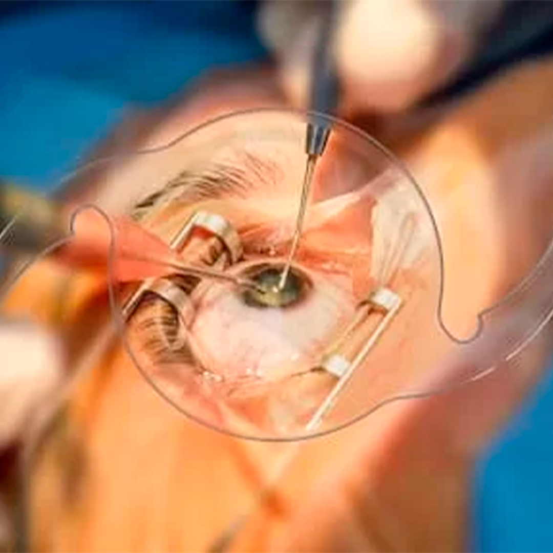 Dra. Laura Vizibelli – Oftalmologista – Cirurgia Refrativa e Catarata